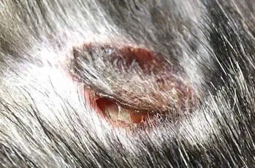 Fortgeschrittene Hot Spot Erkrankung, die operativ zu entfernen ist.